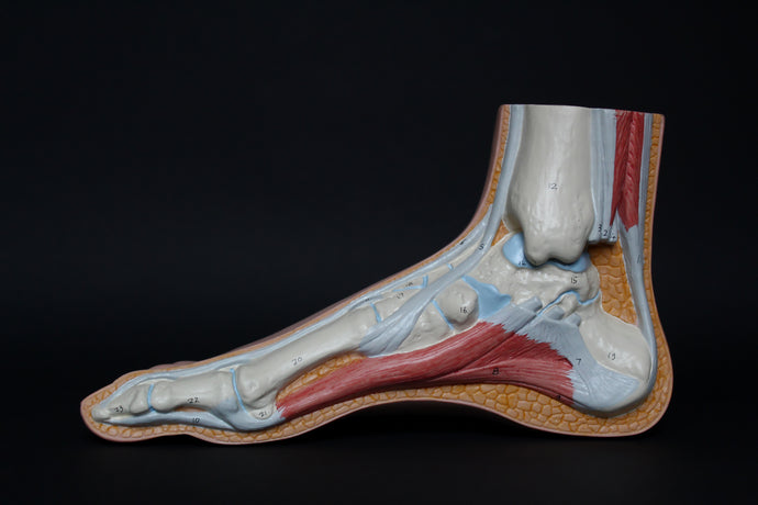 How do I know If I have Plantar Fasciitis?