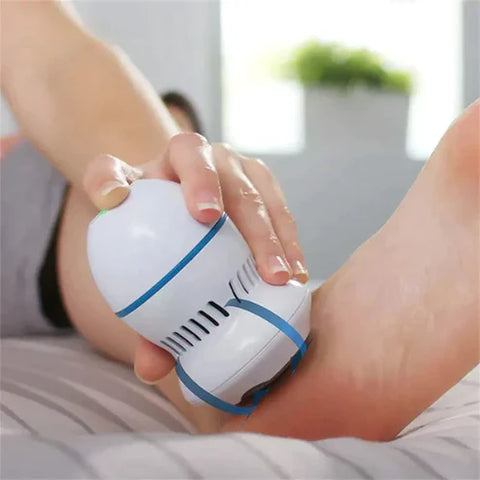 Callus remover for feet